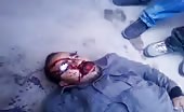 Victim Of Tunisia Protest And Uprising 