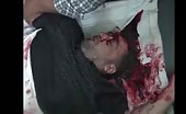 Man Head Cracked Open In Shelling