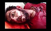 Corpse Of Syrian Civilian