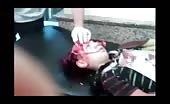 Dead Child With Exploded Head (Graphic Warning)