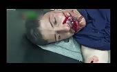 Syrian Boy With Nasty Mouth Injuries