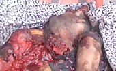 A View Of Civilians Corpses In Darra, Syria