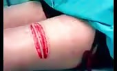 Man Savagely Tortured With Knife Cuts