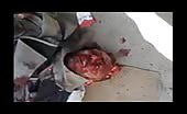 Corpse Of A Man With Cracked Skull