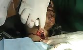 Lady With Slit Throat And Object Inside