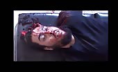 Man With Head Shot And Skull Cracked