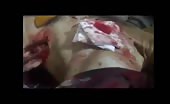 Treatment Of FSA Member Wounded By Bullet Shots