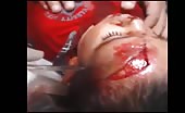 Child With Nasty Head Injury