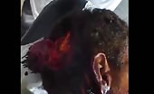 Civilian Brutally Burned And Wounded In The Head