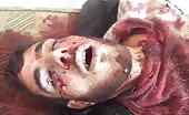 Man Dead And Face Disfigured