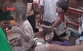 Children Affected in Bombing