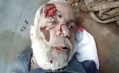 Old Man Dead In Bombing