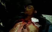 Syrian Bombing Victim