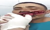 Guy Gets His Mouth Slashed