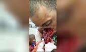 Man's face cut by machete