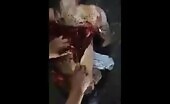 A guy groans in pain when his skin is cut off
