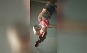 Broken legs after incident s murders, execu