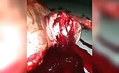 Stabbing murders and suicides