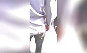 Man's leg severed, rests on skin