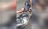 The meat of a lady's leg is torn off after a mishap un