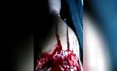 Man suffers severe knee injury in accident