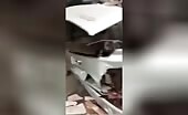 Truck driver's disfigured face aftermath