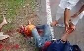 Motorcyclists lose legs in accident