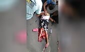 Woman crashed with shattered leg s murder
