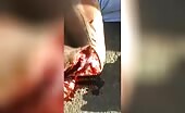 Youth suffers severe injury after bike accident