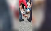 Motorcyclist's Arm Severed in Crash