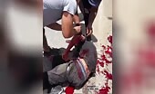 Motorbike Crash in Venezuela Turns Bloody