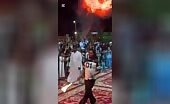 Fire Breather Suffers Burns