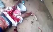Man's Face Smashed by Axe