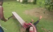 Man's Hand Cut Off in Violent Attack